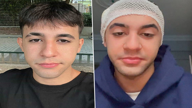 Tartışmaya girdiği taksicisi, motosiklet sürücüsünü sopayla yaraladı