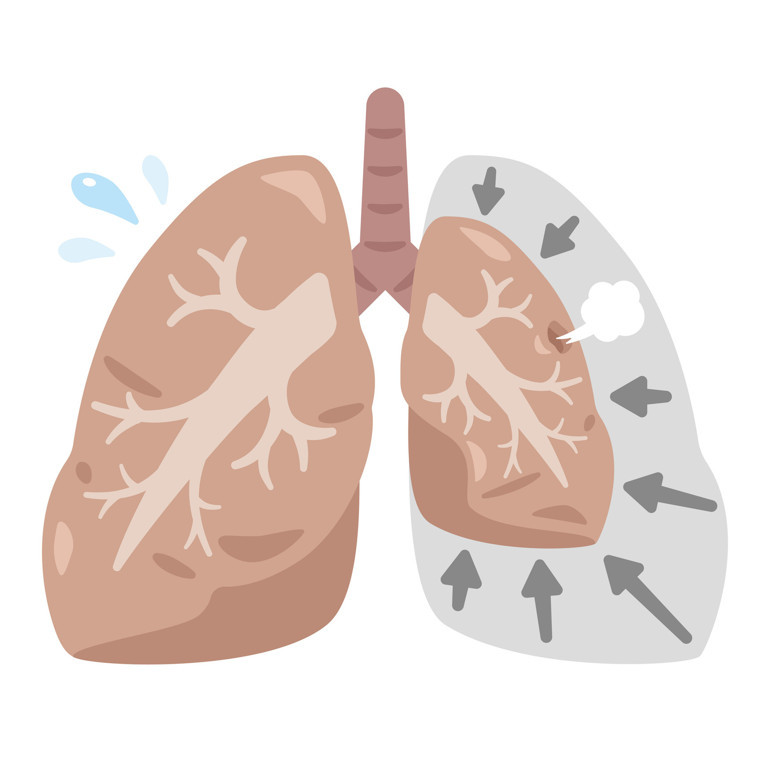 Elektronik sigara akciğeri söndürüyor... Kullanım yaşı 11’e kadar düştü