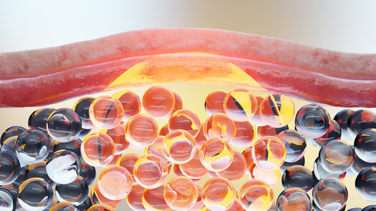 Titremek yağ yakmaya yardımcı olur mu 15 dakikası 1 saatlik egzersize denk Sihirli gibi pazarlanıyor ama etkisi kalıcı mı