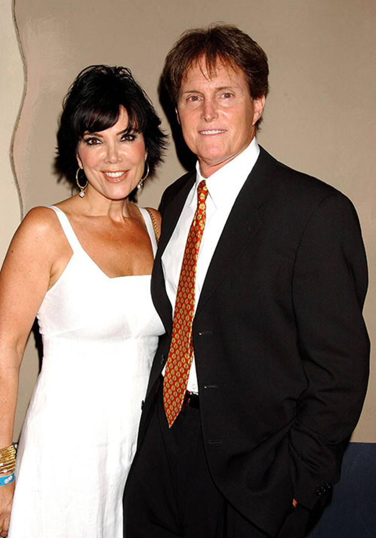 Servetim bitecek diye hiç korkmuyor... Güzelleşmek için avuç avuç para harcıyor: Yüzümdeki tek doğal şey burnum