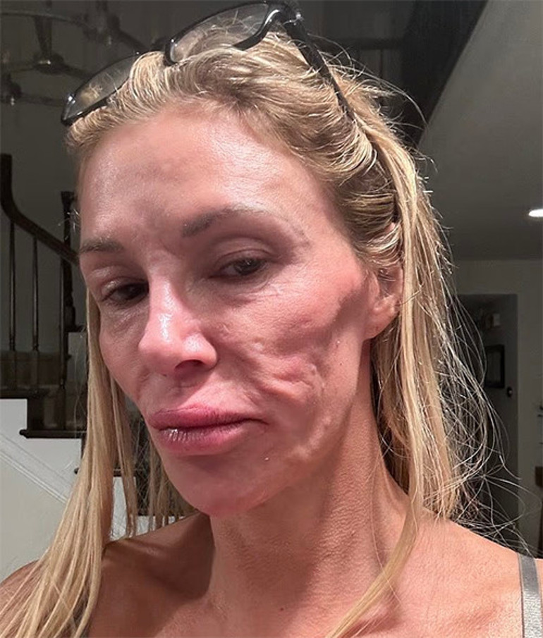  Sonunda teşhis konuldu