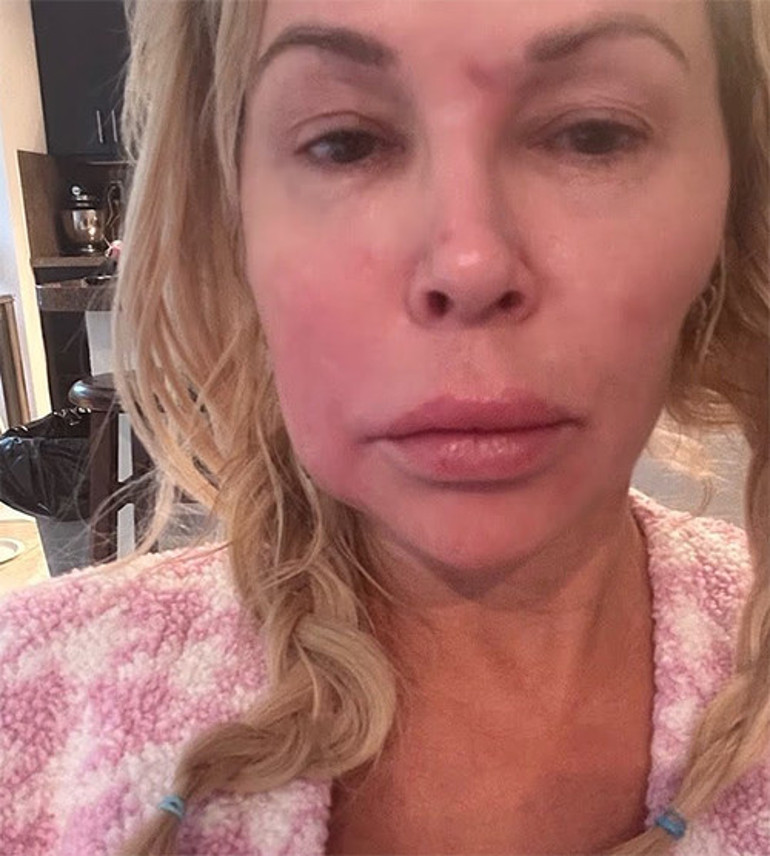  Sonunda teşhis konuldu