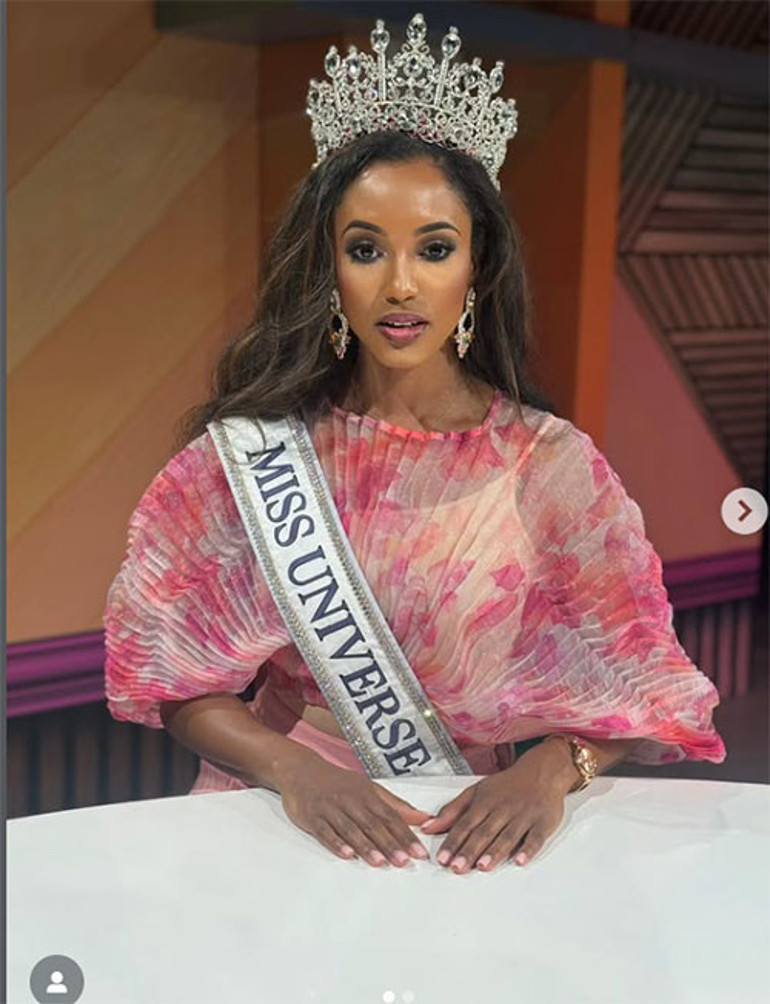 20 gündür hastanede yaşam mücadelesi veriyor: Olaylı yarışmanın gerçek kurbanı: Kainat Güzeli olmak isterken hayatı kabusa döndü...