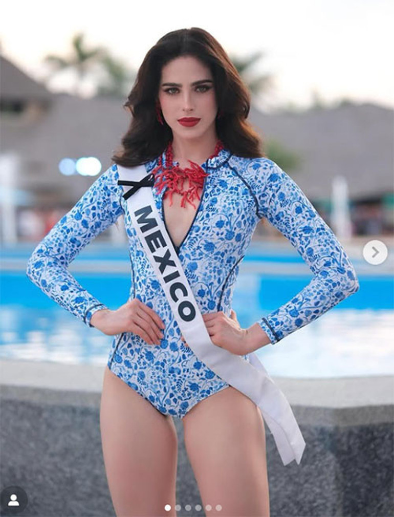 20 gündür hastanede yaşam mücadelesi veriyor: Olaylı yarışmanın gerçek kurbanı: Kainat Güzeli olmak isterken hayatı kabusa döndü...