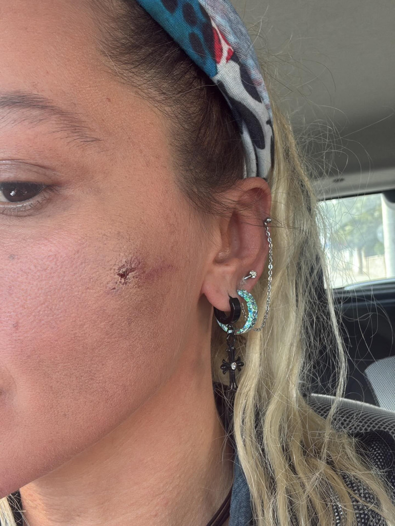 Ünlü oyuncu Yıldız Asyalıdan şoke eden iddia: Kocam tarafından darp edildim