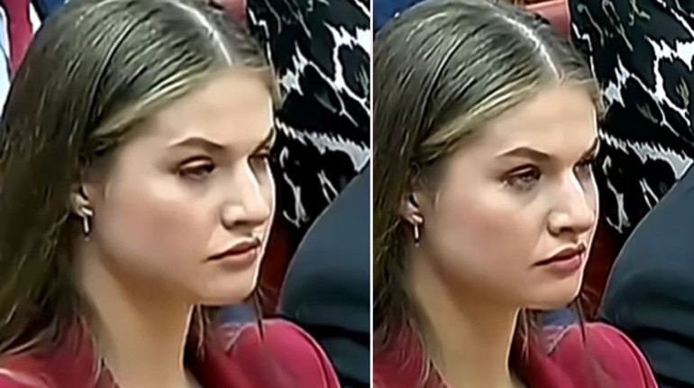 Güzel gözlerini açık tutamadı: Gizli hastalığı ifşa oldu