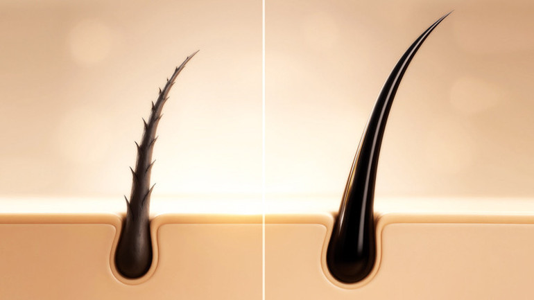 Dünya bu ilacı konuşuyor: Kelliğe merhem umudu