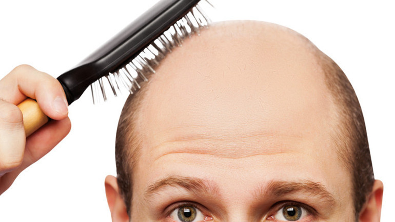 Dünya bu ilacı konuşuyor: Kelliğe merhem umudu