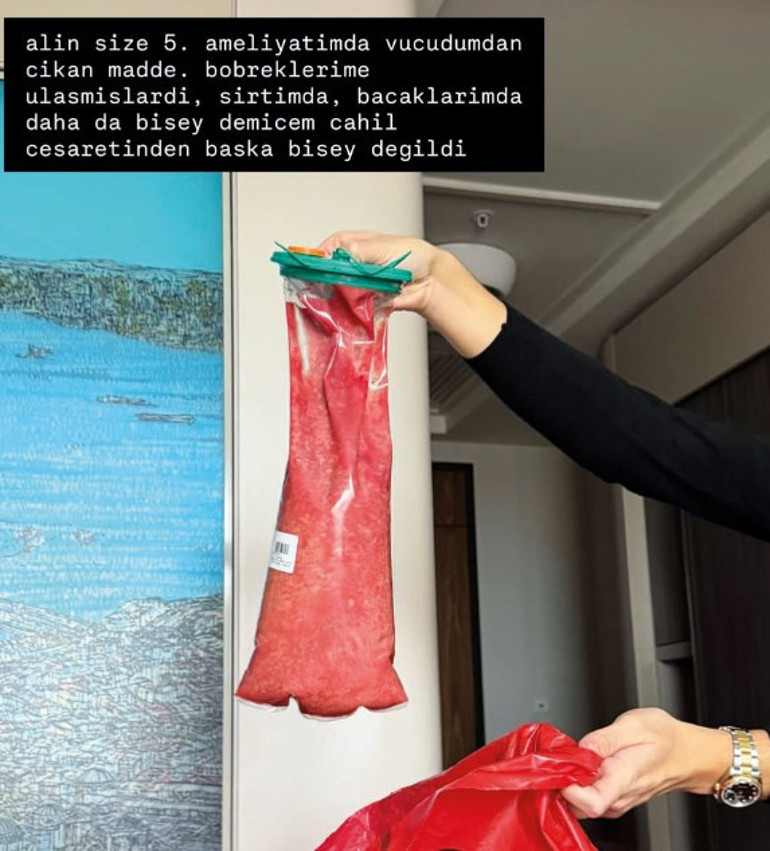 Danla Bilic 5. kez ameliyat oldu