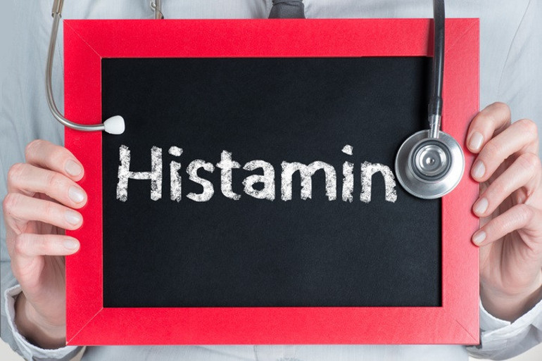 Histamin İntoleransı: Neden bu kadar yaygın oldu Fark etmeden yaşıyor olabilirsiniz
