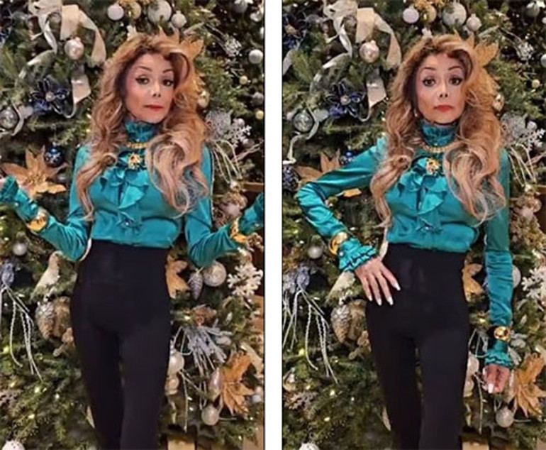 Gizemli hastalığı ünlü şarkıcıyı kuklaya benzetti... Hayranları artık onu görünce korkuyor