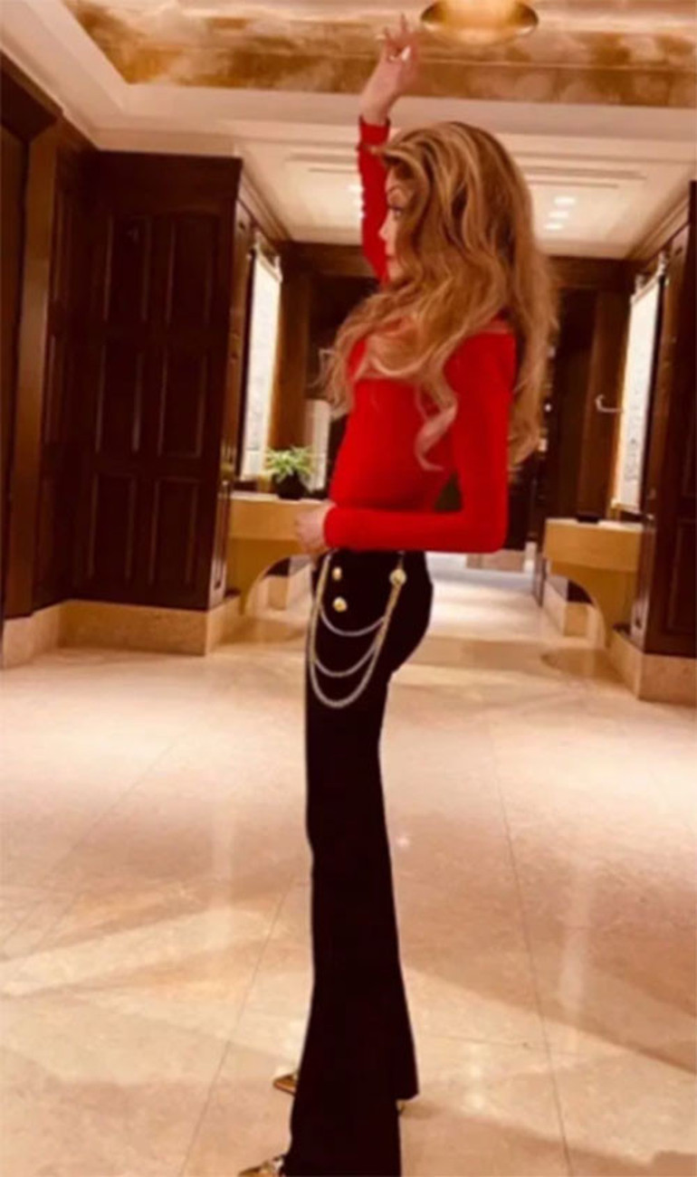 Gizemli hastalığı ünlü şarkıcıyı kuklaya benzetti... Hayranları artık onu görünce korkuyor