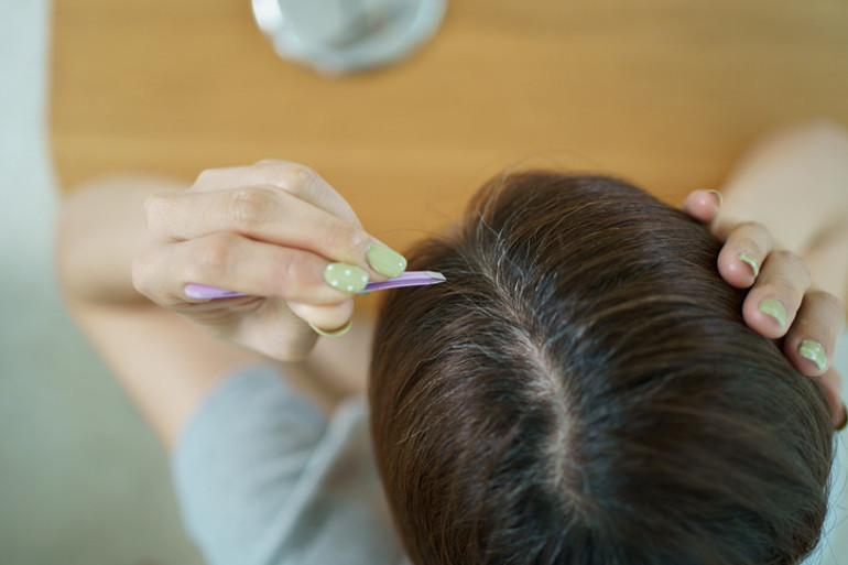 Saç beyazlamasını yavaşlatmak hatta tersine çevirmek mümkün mü Uzmanlar uyarıyor Cımbızdan uzak durun