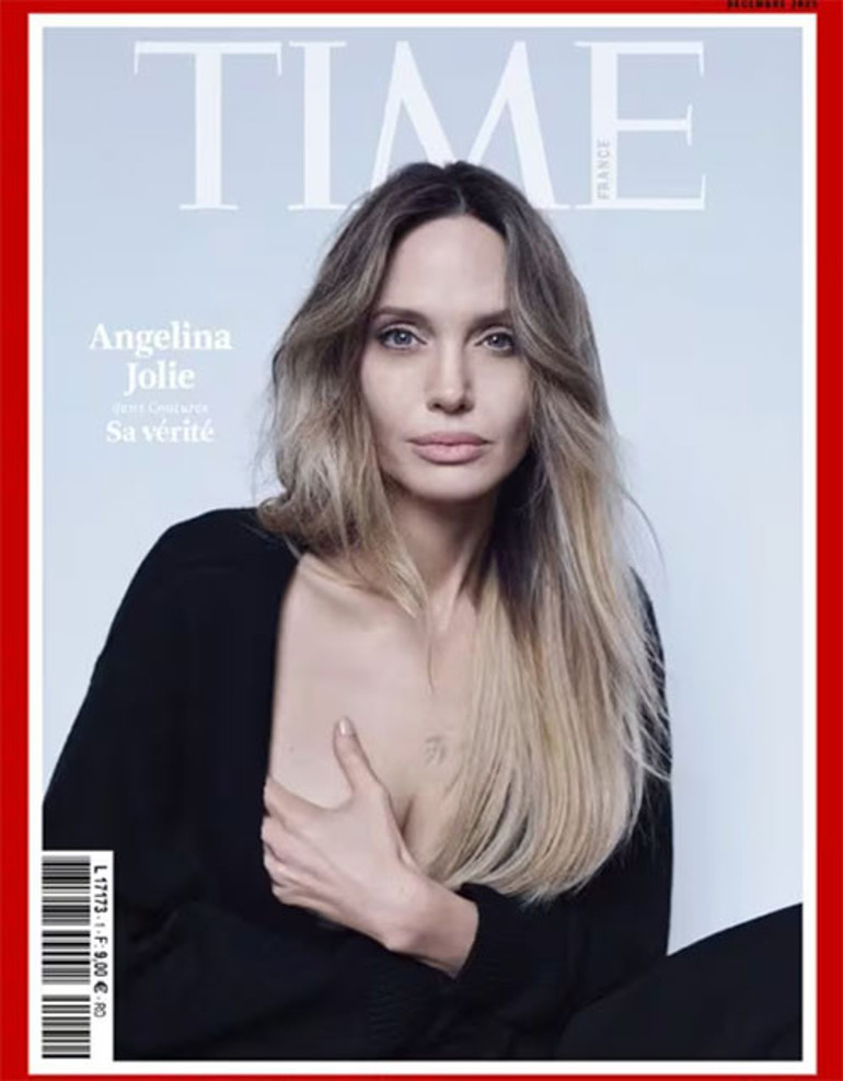 Kansere yakalanmamak için iki memesini de aldırmıştı... Yara izlerini ilk kez kapak pozunda gösterdi