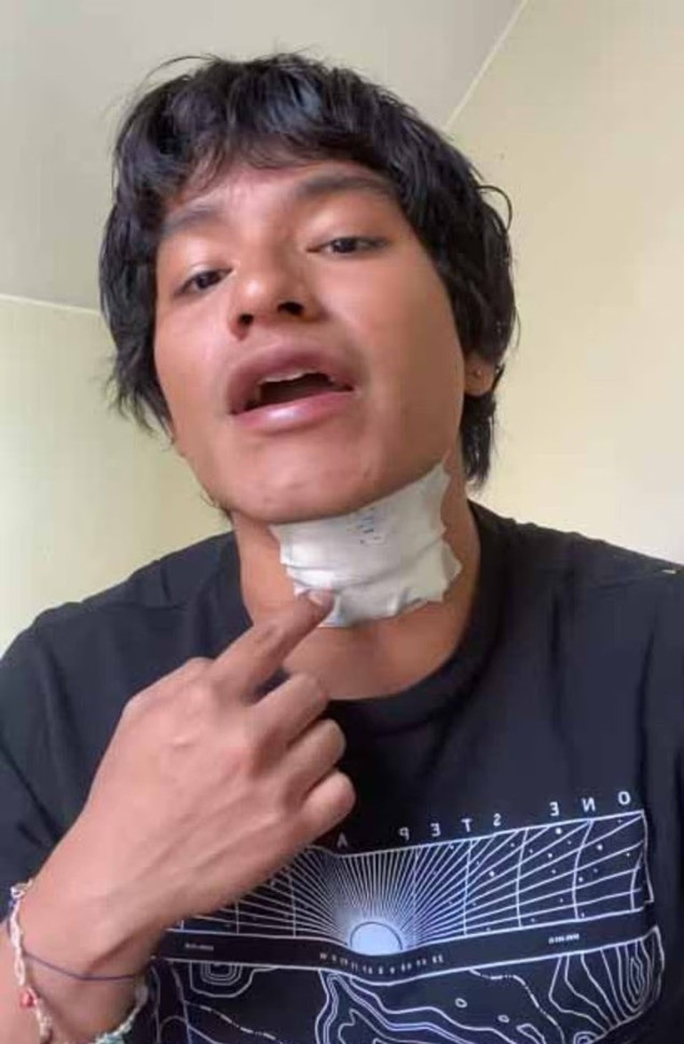  Konserde elektrik akımına kapılarak yere yığıldı