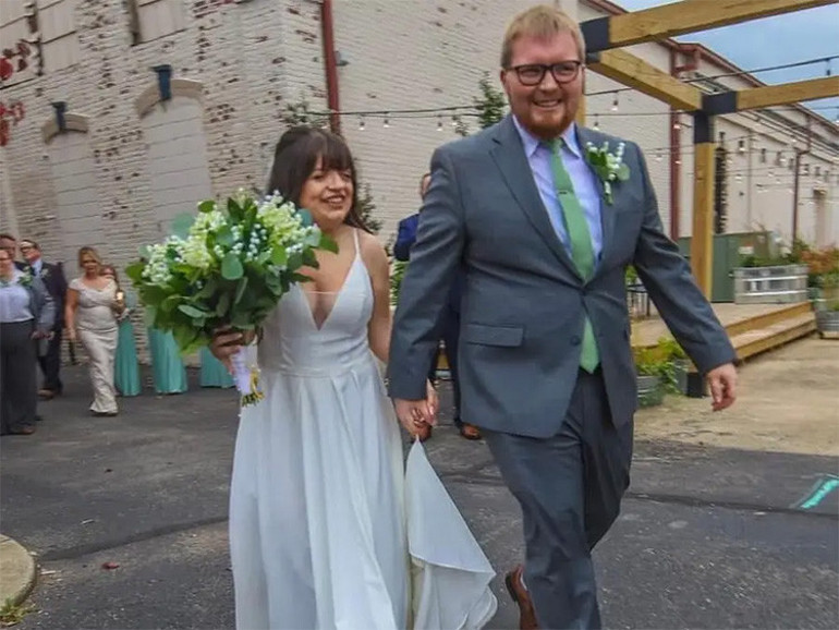 Nadir bir genetik durumla doğdu, doktorlarını bile şaşırttı... Yıllarca meraklı bakışlara maruz kaldı Nasıl başardığını anlattı