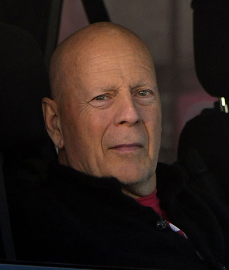 Üç yıldır demansla boğuşuyor... Ailesi ölümünden sonra beynini bilimin hizmetine bağışlayacak