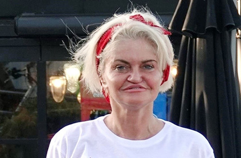 Erken gelen şöhret hayatını kararttı... Dağılan yüzünü toplamak için servet harcıyor: Aynaya bakamaz oldum