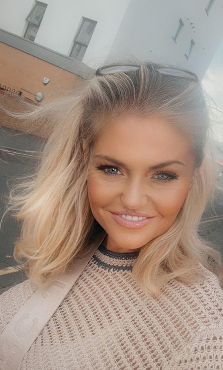 Erken gelen şöhret hayatını kararttı... Dağılan yüzünü toplamak için servet harcıyor: Aynaya bakamaz oldum