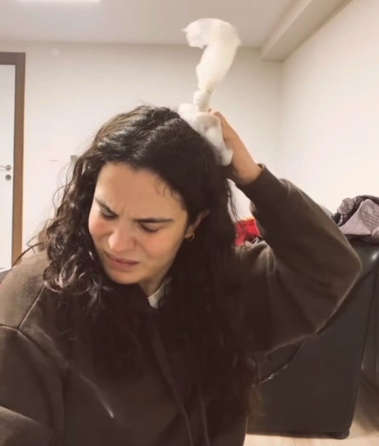 Sahnede kafasına kapı düştü