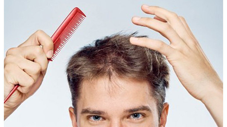 Saç dökülmesi neden olur Saç dökülmesine ne iyi gelir