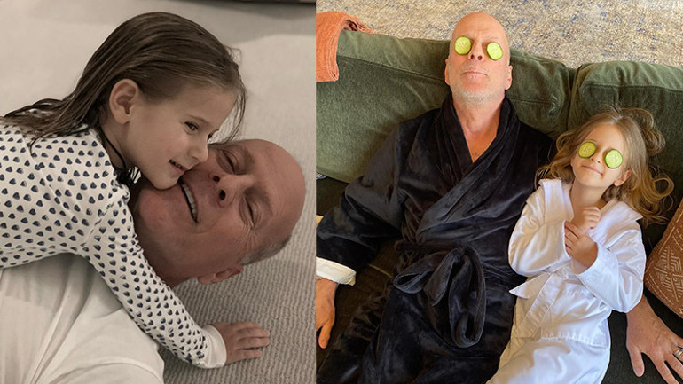 Demansla boğuşan ünlü oyuncunun eşinden yürek burkan paylaşım… ‘18 yıl önce saçlarımı öptü, o an sanki zaman durdu’