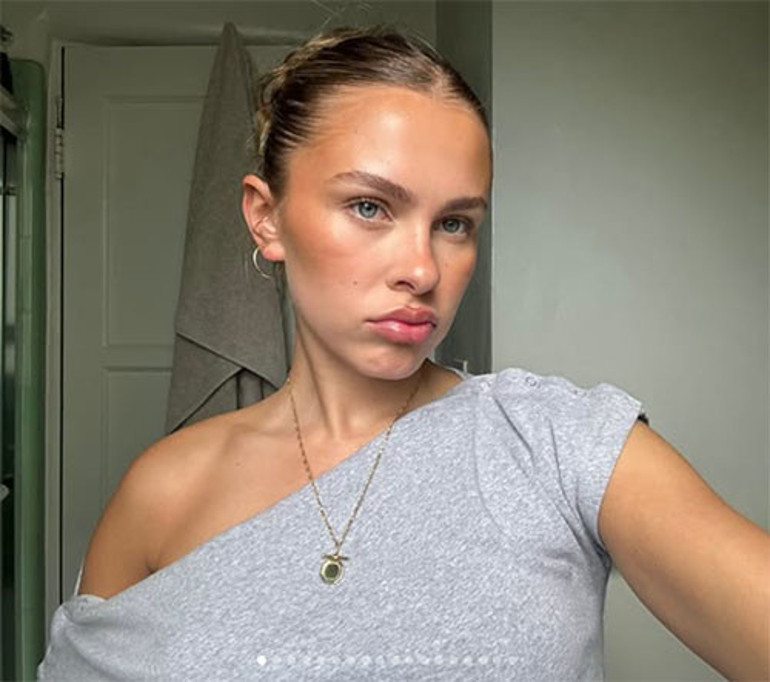  Gülüşümde bir tuhaflık vardı... Beyin kanserine yakalanmışım