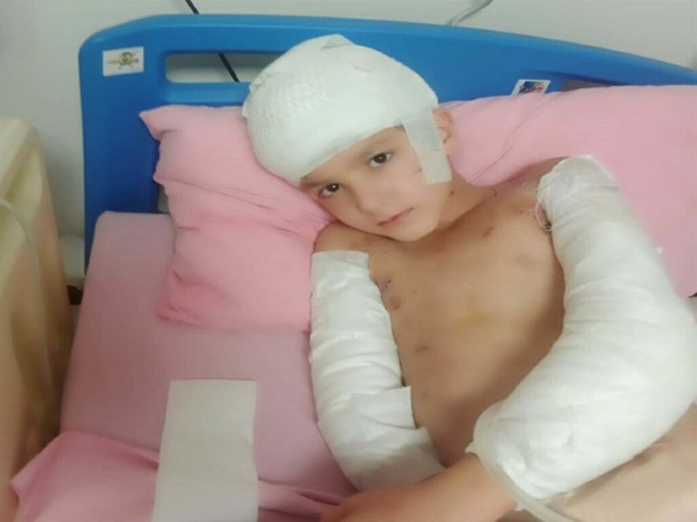 12 yaşındaki Tunahanın hayatını kabusa döndü Sokak köpeği saldırısında aileye 5 milyon lira tazminat ödenecek