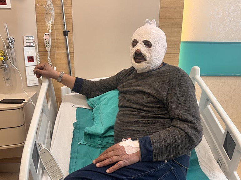 Arkadaşına yardım etmek istedi: Az daha canından oluyordu Ben yandım kimse yanmasın