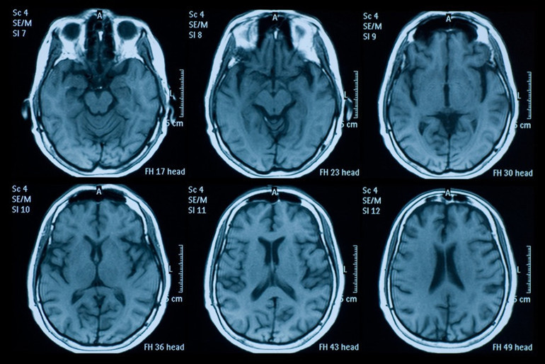 ABDden Havana Sendromu hamlesi: Gizemli cihaza sessiz operasyon... 8 haneli ödeme yapıldı