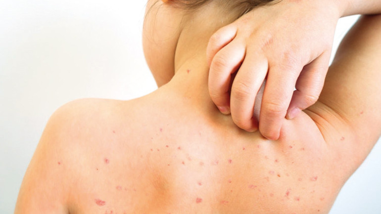  Mutlaka 2 doz aşı yapılmalı