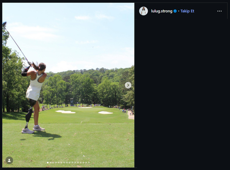  Kolumu sudan çıkardım, elim yoktu 30 saniye içinde ölmesi beklenirken nasıl hayatta kaldı