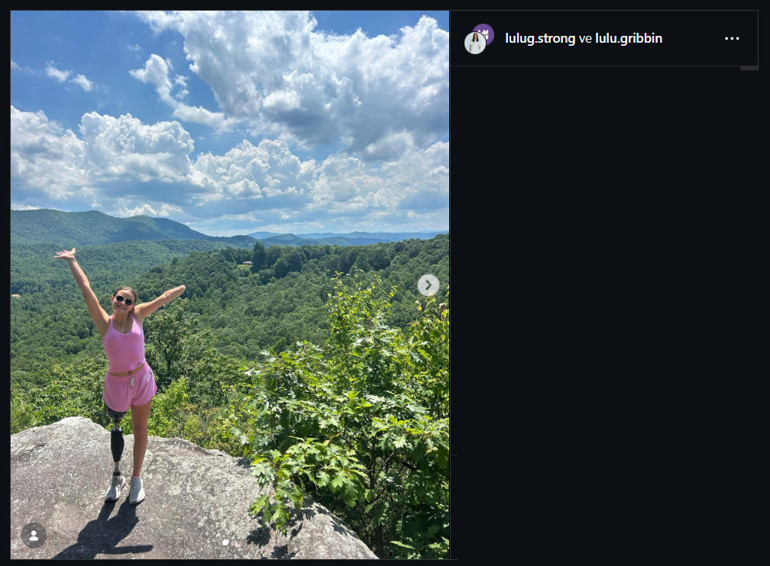  Kolumu sudan çıkardım, elim yoktu 30 saniye içinde ölmesi beklenirken nasıl hayatta kaldı