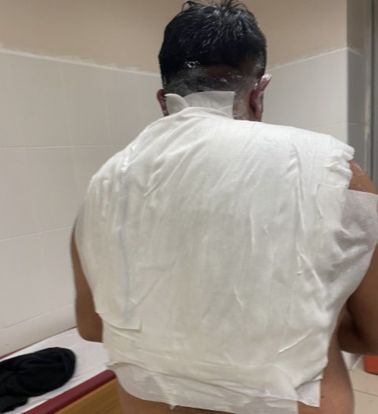  Havaya attı, acı içinde kıvrandı