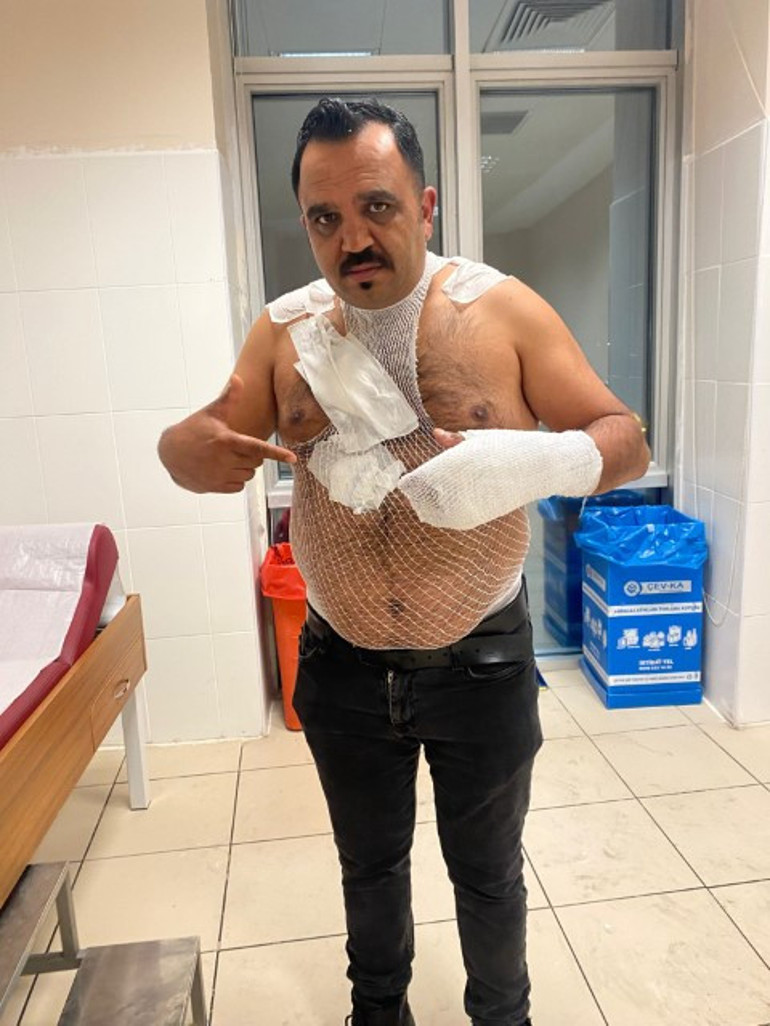  Havaya attı, acı içinde kıvrandı