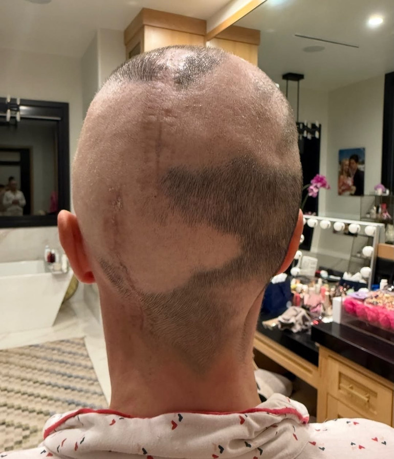 Evlilik biter, vefa kalır… Ayrıldığı karısı kanser olunca başucunda bekledi