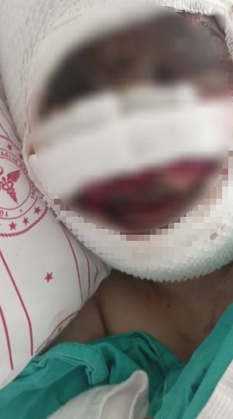  Koli bandı ile bağlayıp, başından aşağı kezzap döktü