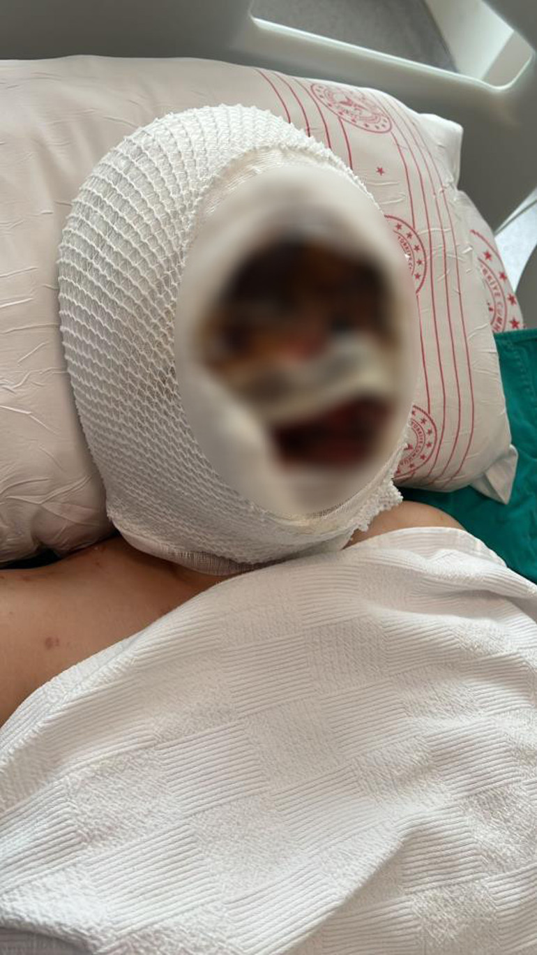  Koli bandı ile bağlayıp, başından aşağı kezzap döktü