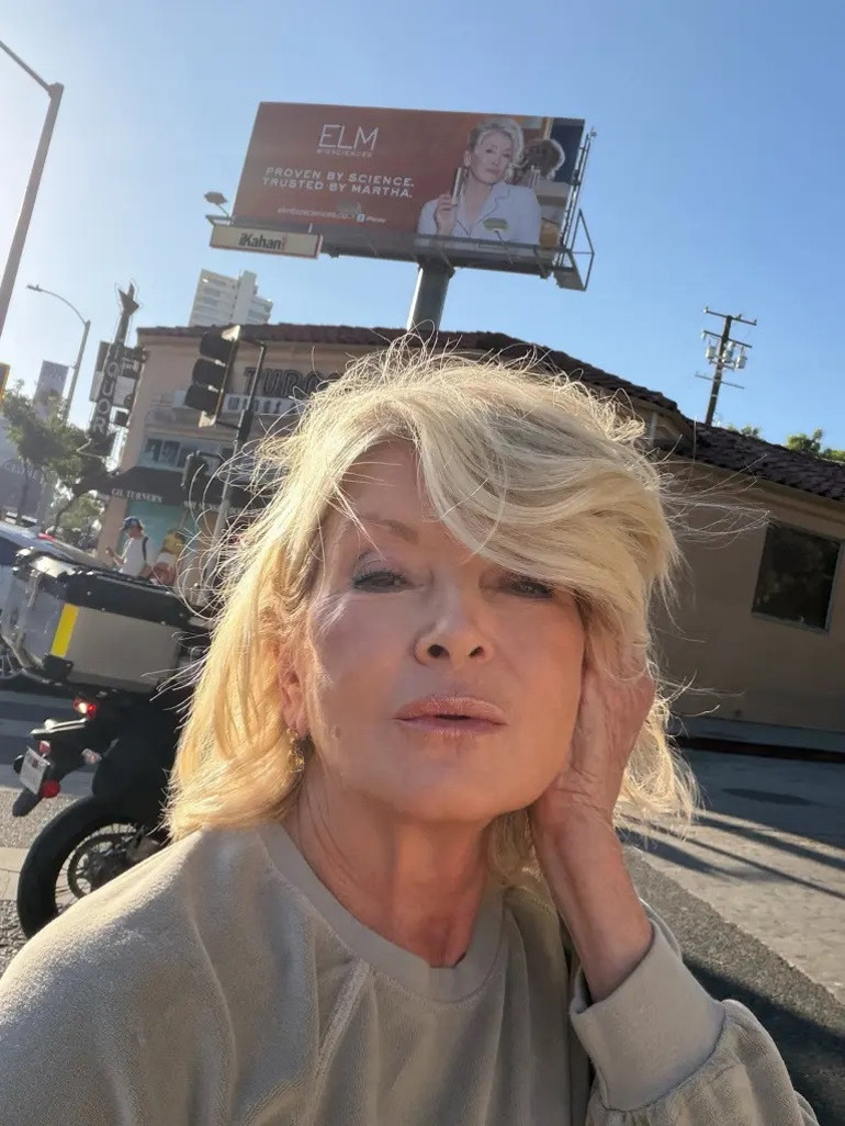 84 yaşında ama genç kızlarla yarışıyor… Ünlü sunucu estetik iddialarını yanıtladı