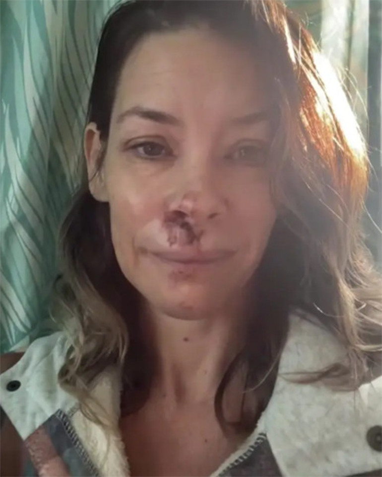 Ünlü oyuncu emekliliğin keyfini bile süremedi... Beyin sarsıntısı geçirdim... İyileşmek için çok para harcadım