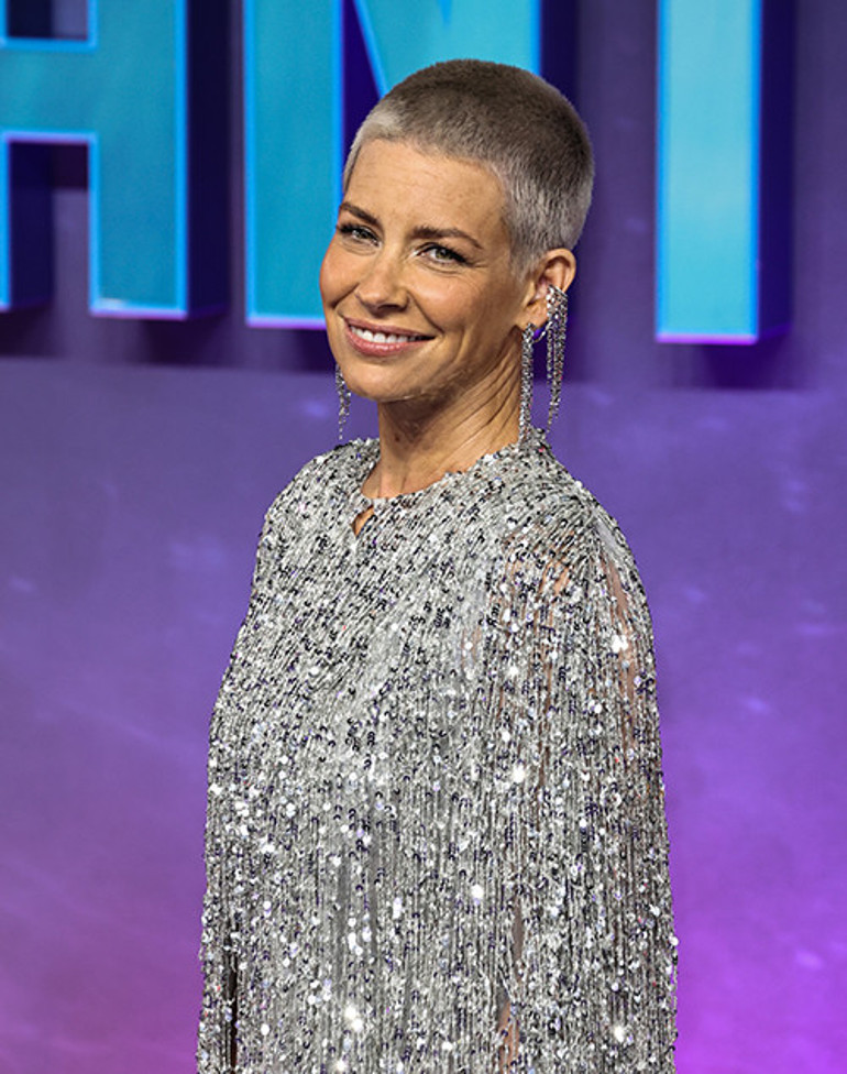 Ünlü oyuncu emekliliğin keyfini bile süremedi... Beyin sarsıntısı geçirdim... İyileşmek için çok para harcadım