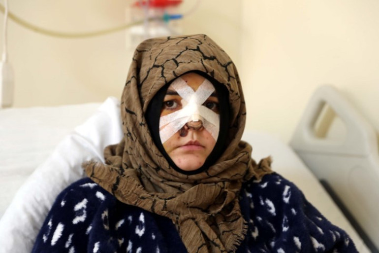 Kaldırım taşı ile saldırdı, Nazlının kabusu oldu | Çıkarsa yarım bıraktığı işi yapacak