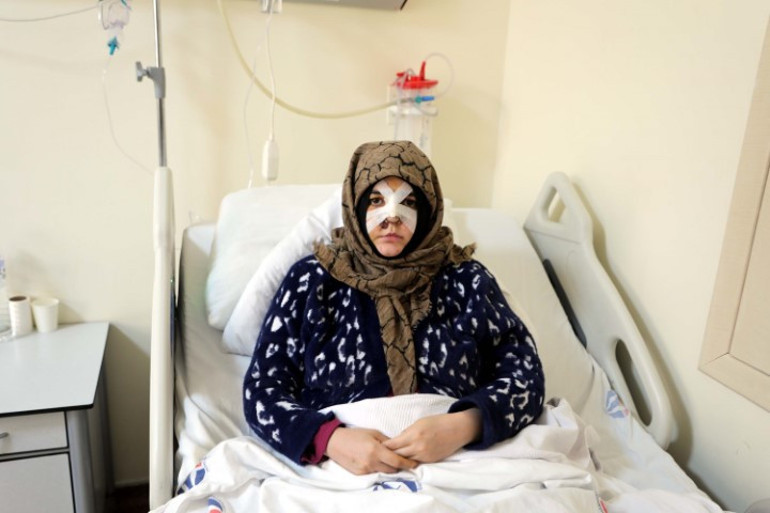 Kaldırım taşı ile saldırdı, Nazlının kabusu oldu | Çıkarsa yarım bıraktığı işi yapacak