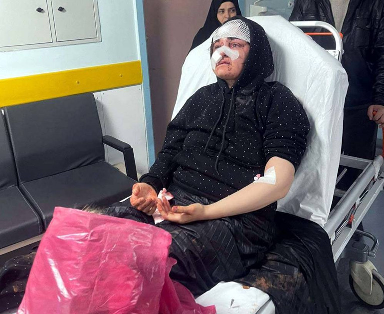 Kaldırım taşı ile saldırdı, Nazlının kabusu oldu | Çıkarsa yarım bıraktığı işi yapacak