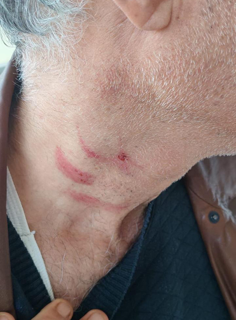 Aile hekimini darbeden müezzin savcılığın itirazı ile yeniden gözaltına alınıp tutuklandı