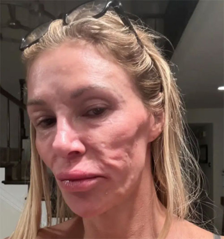 Gizemli hastalığı beş yıl boyunca ünlü oyuncuyu kemirip durdu: Durmadan yemek yediği halde damla damla eriyordu