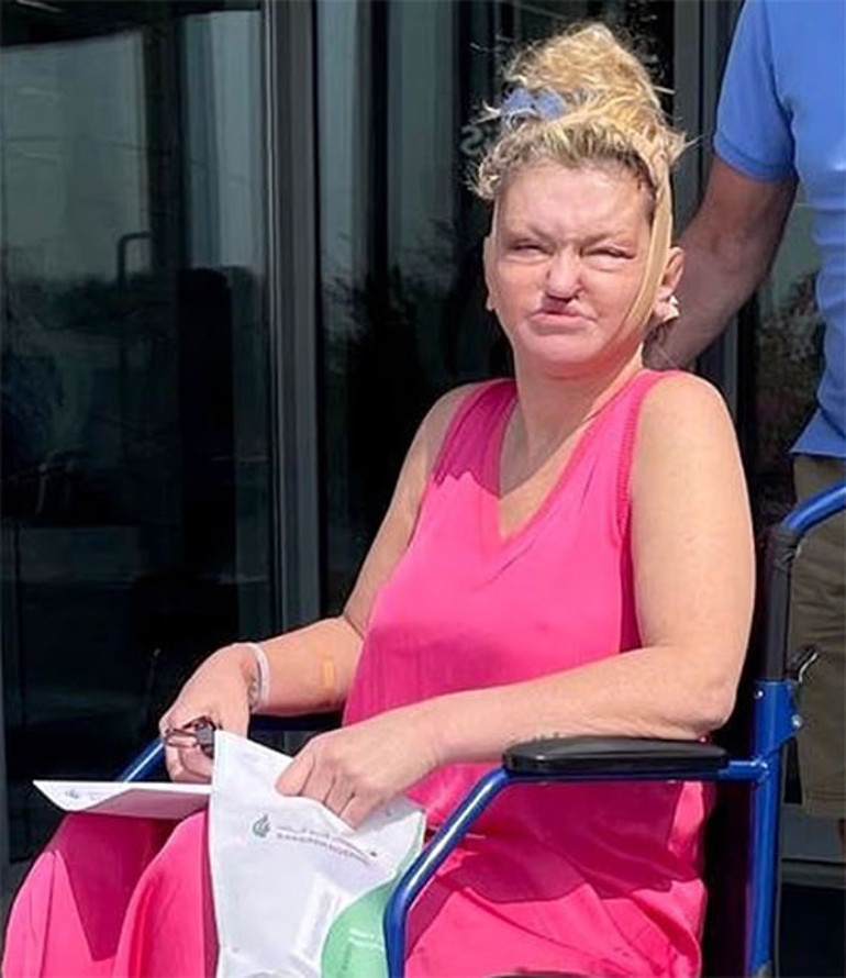 O bebeksi görüntüsü hatıralarda kaldı... Güzelleşme hırsı ünlü oyuncunun yüzünü de parasını da aldı götürdü