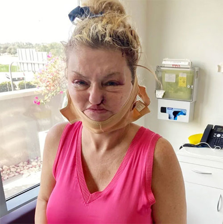 O bebeksi görüntüsü hatıralarda kaldı... Güzelleşme hırsı ünlü oyuncunun yüzünü de parasını da aldı götürdü