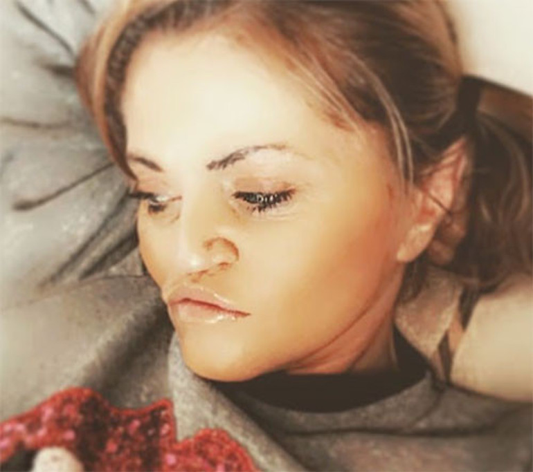 O bebeksi görüntüsü hatıralarda kaldı... Güzelleşme hırsı ünlü oyuncunun yüzünü de parasını da aldı götürdü