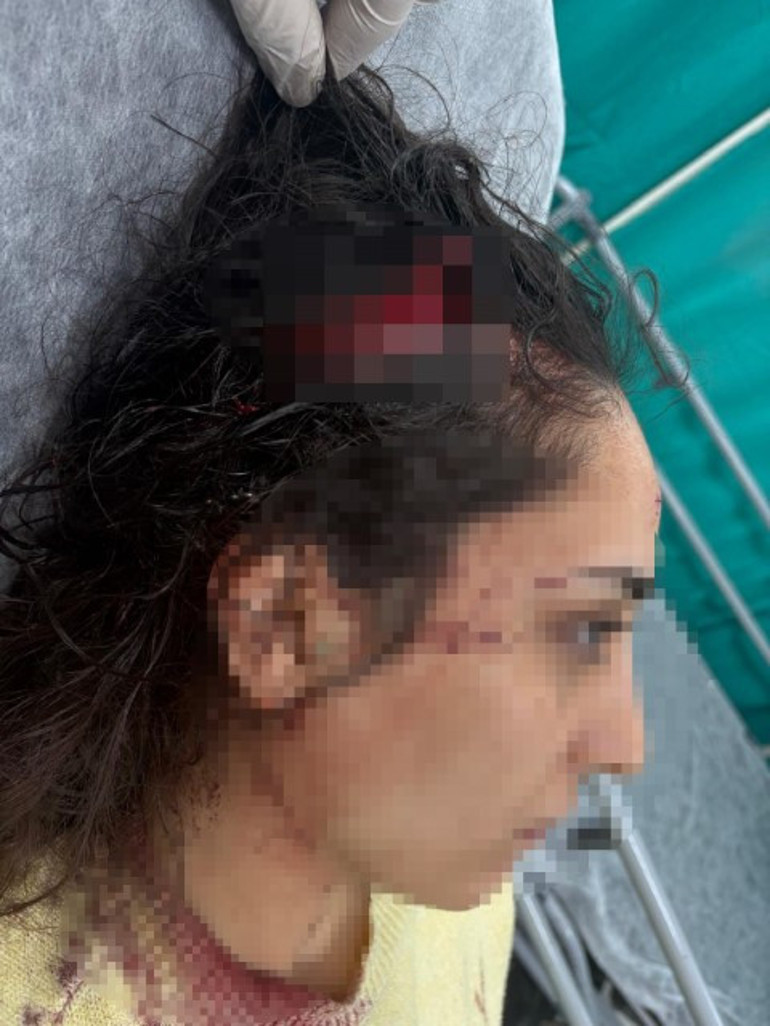 Bakkala giden genç kadın sokak köpeklerinin saldırısına uğradı